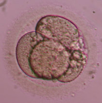 4-cell Grade II